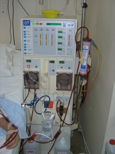 Κινδυνεύουν οι νεφροπαθείς καταγγελλία της νεφρολόγου της  Μονάδας Τεχνητού Νεφρού Νοσοκομείου της Κοζάνης  στο υπουργείο Υγείας